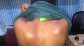 Leona Bangun diduga dianiaya oleh oknum TNI