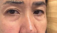 Ervina Fariani melayangkan pengaduan resmi ke Majelis Kehormatan Dewan (MKD) DPR RI terhadap mantan suaminya, RHB, yang merupakan Anggota DPR RI dari Partai Nasdem Dapil Sumut III, atas dugaan kekerasan dalam rumah tangga (KDRT) serta pelanggaran Kode Etik Anggota DPR RI. (Foto: Istimewa)