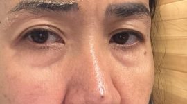 Ervina Fariani melayangkan pengaduan resmi ke Majelis Kehormatan Dewan (MKD) DPR RI terhadap mantan suaminya, RHB, yang merupakan Anggota DPR RI dari Partai Nasdem Dapil Sumut III, atas dugaan kekerasan dalam rumah tangga (KDRT) serta pelanggaran Kode Etik Anggota DPR RI. (Foto: Istimewa)