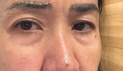 Ervina Fariani melayangkan pengaduan resmi ke Majelis Kehormatan Dewan (MKD) DPR RI terhadap mantan suaminya, RHB, yang merupakan Anggota DPR RI dari Partai Nasdem Dapil Sumut III, atas dugaan kekerasan dalam rumah tangga (KDRT) serta pelanggaran Kode Etik Anggota DPR RI. (Foto: Istimewa)